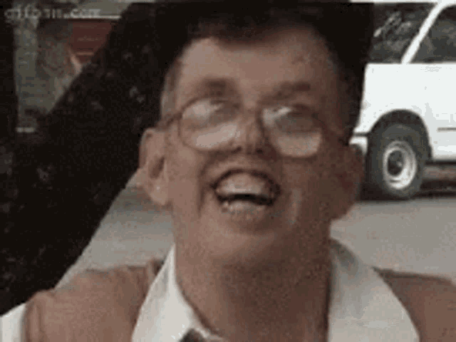 retard-dumb.gif.055adcd117ee184ddeb513fcf63d2d95.gif